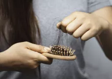 Más cabello en el cepillo